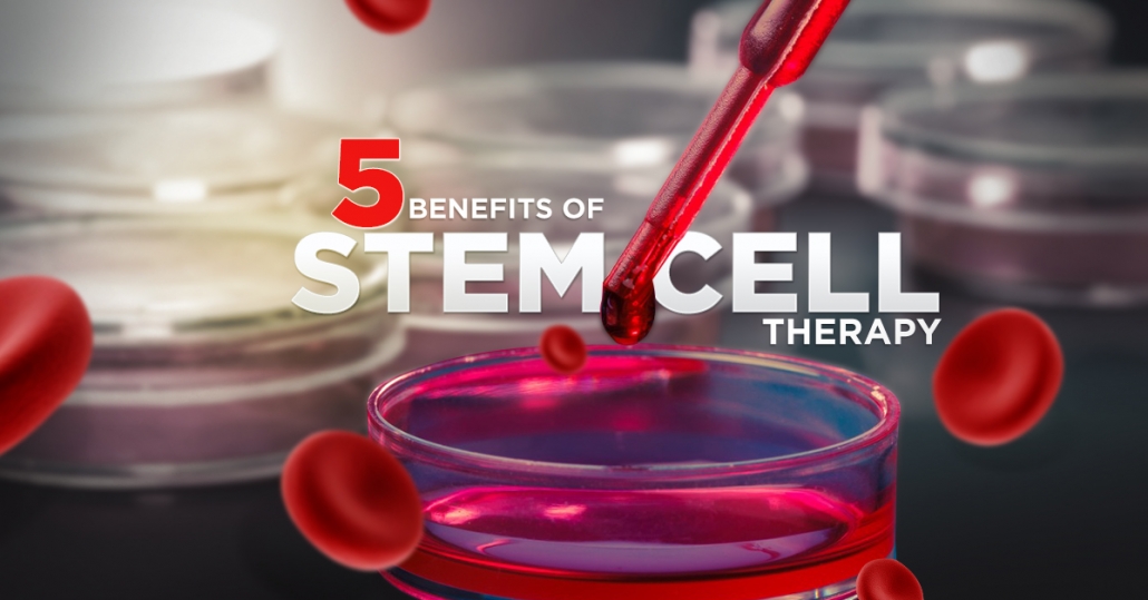 Benefits of Stem Cells