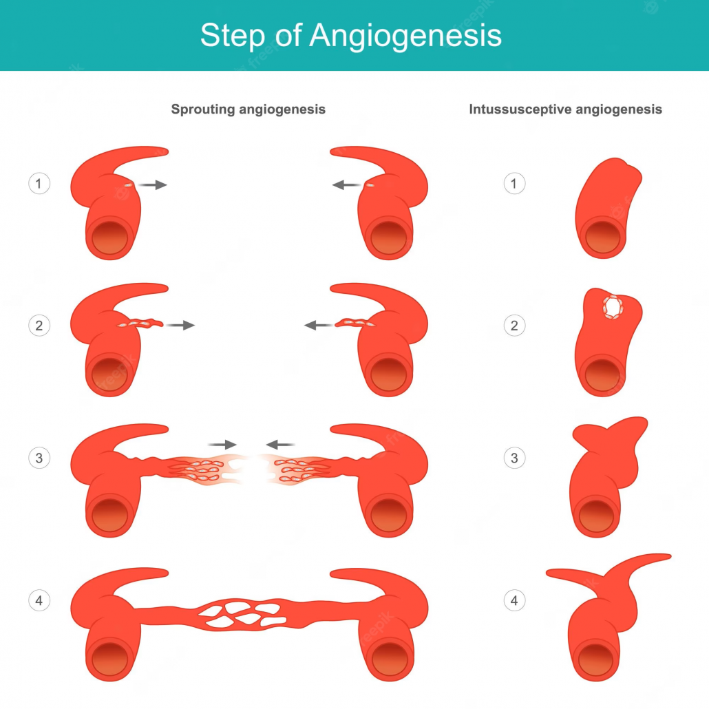 eecp angiogenesis